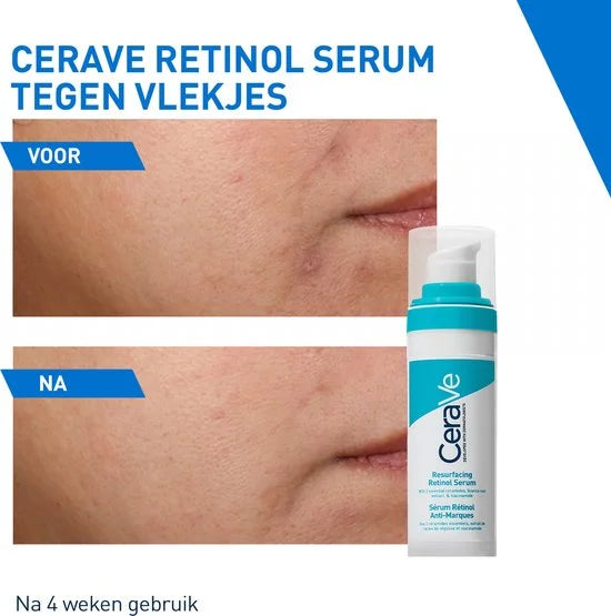 CeraVe Anti-Onzuiverheden Retinol Serum - tegen Vlekjes en Restlittekens - voor een Onzuivere Huid met Neiging tot Acne - 30ml
