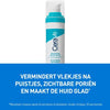 CeraVe Anti-Onzuiverheden Retinol Serum - tegen Vlekjes en Restlittekens - voor een Onzuivere Huid met Neiging tot Acne - 30ml
